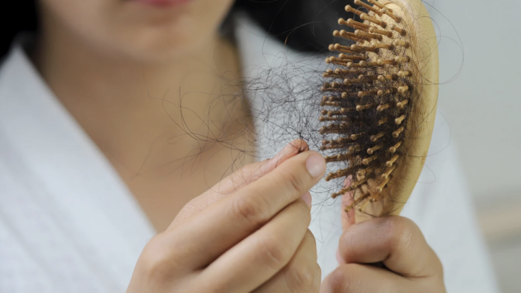 Top-Rated Dermatologist for Thinning Hair Near Bel Air, Maryland